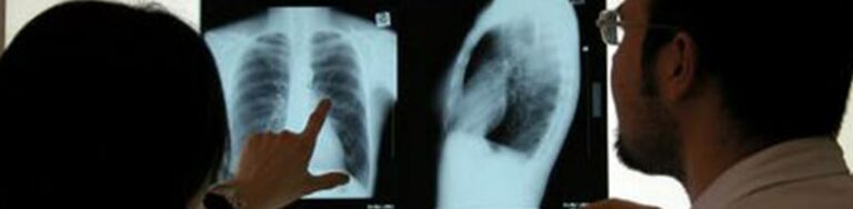 How Long Does It Take To Recover From A Car Accident? | Long Beach