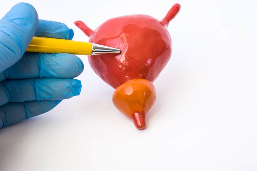 gloved hand holding a pencil pointing towards a fake bladder