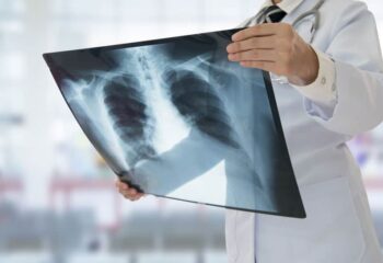 doctor looking at a chest x-ray