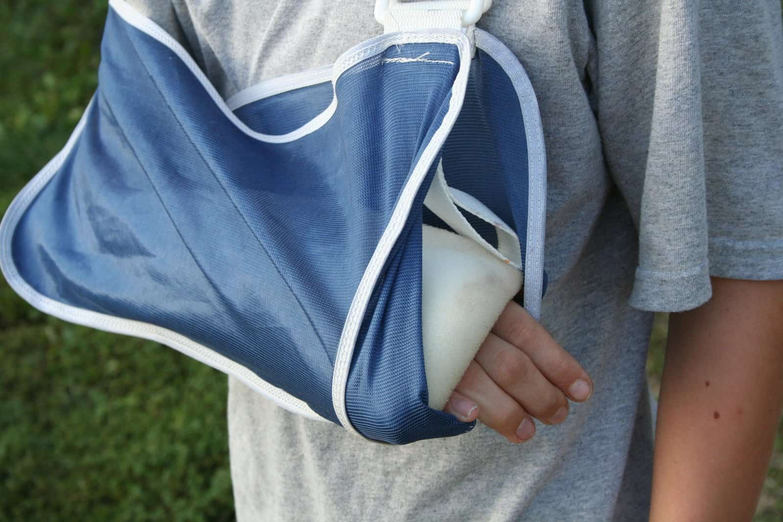 close up of a broken arm in sling and cast