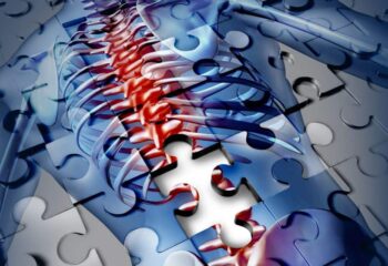 puzzle pieces making up an image of a spine