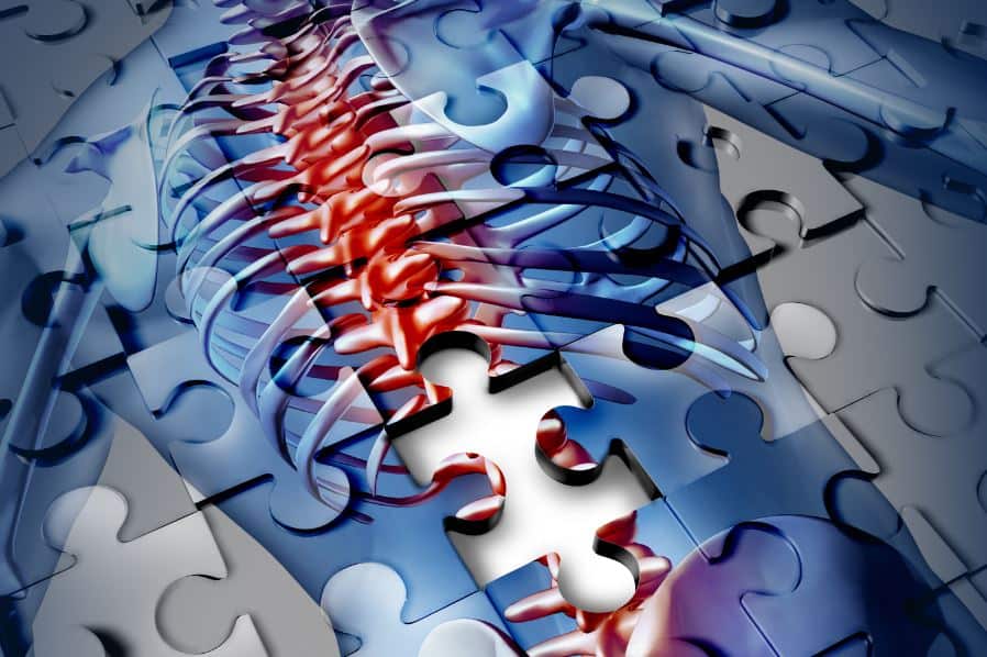 puzzle pieces making up an image of a spine