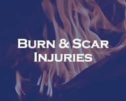 Burn And Scar Injuries - blue over a close up of flames and a fire